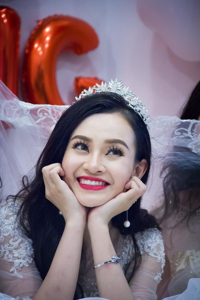 dao binh nhi the voice rat tu ti voi guong mat khong hoan chinh cua minh