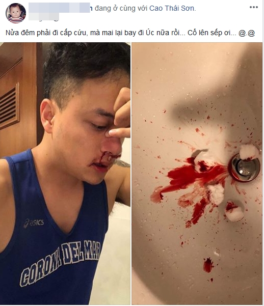 cao thai son bi vo mach mau mui tiet lo tinh trang nguy hiem tinh mang