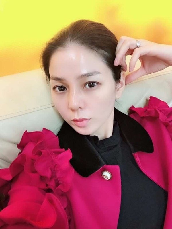 Lệ Quyên phải tháo sụn mũi giả vì hoại tử, ảnh hưởng đến tính mạng le quyen phai thao sun mui gia vi hoai tu anh huong den tinh mang