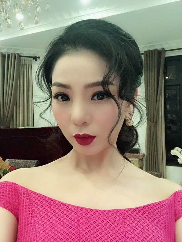 Lệ Quyên phải tháo sụn mũi giả vì hoại tử, ảnh hưởng đến tính mạng le quyen phai thao sun mui gia vi hoai tu anh huong den tinh mang