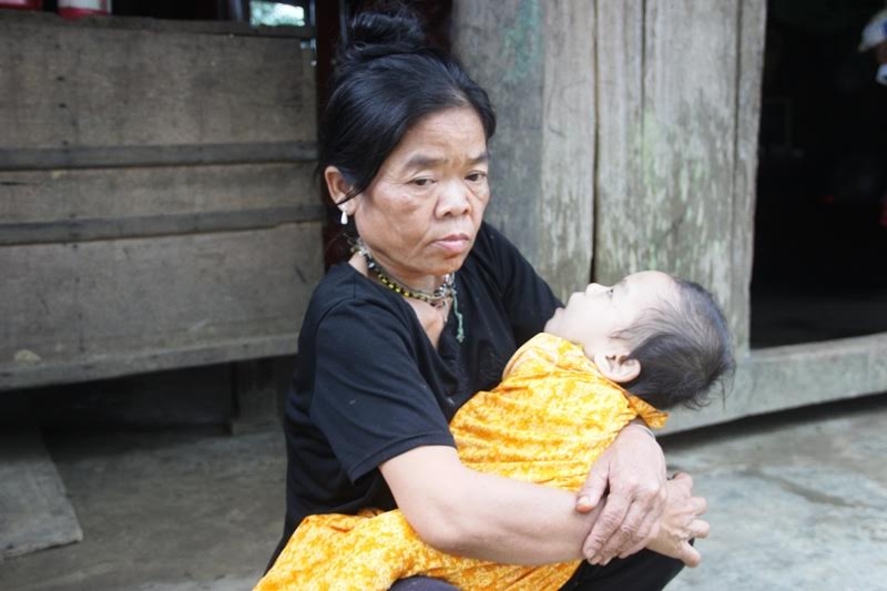 dang sau nhung cuoc hon nhan can huyet thong cua nguoi chut bai cho ngay dep