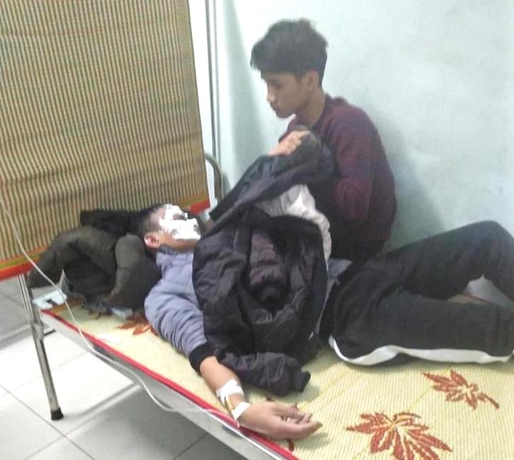 dung lua thu xang nam sinh 16 tuoi bi bong nang