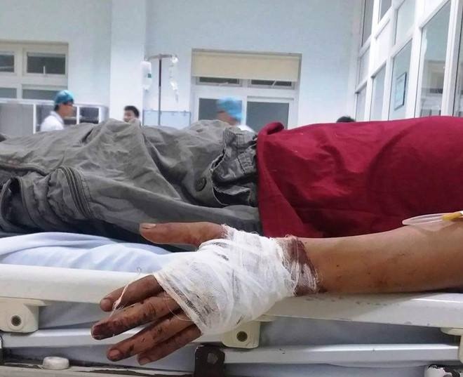 nghe an tranh gianh khach bi hang xom chem gan dut lia tay trai
