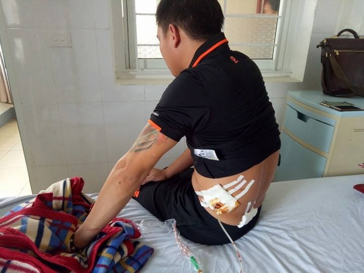 no sung tai quan hat 4 nguoi nhap vien trong dem 53150