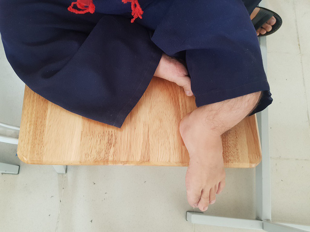nghi luc den truong cua nam sinh ti hon 18 tuoi nang 20kg