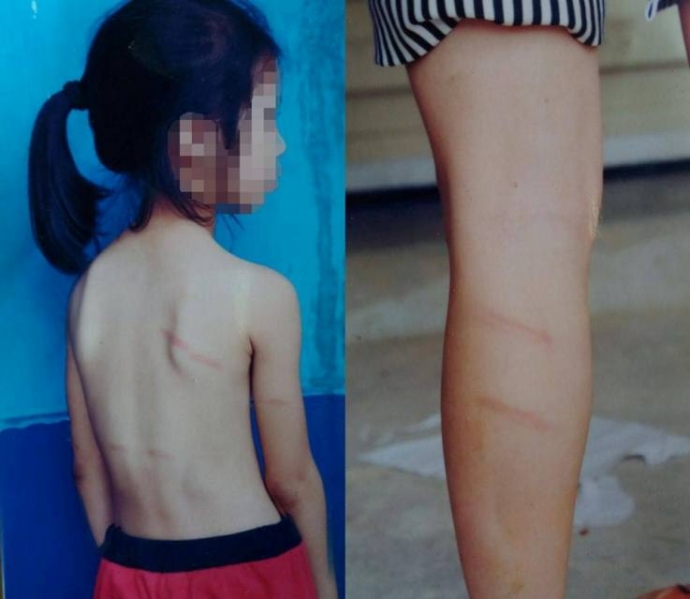 co giao nghe an danh be tieu hoc tim tai mat vi khong hoc duoc bai