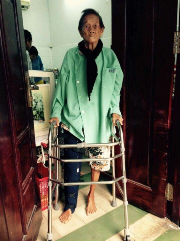 thay khop hang cho cu ba gan 100 tuoi trong vong 30 phut
