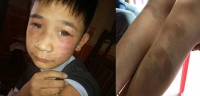 lui vao xe cua nu pho giam doc bv tim ha noi nam thanh nien xuong xe chui boi hanh hung