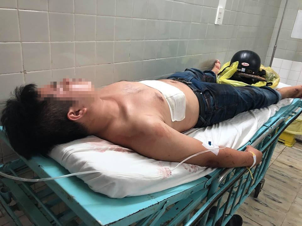 vu hiep si bi dam chet o tp hcm nhin tu luc luong 141 ha noi