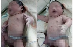 Vĩnh Phúc: Bé trai chào đời nặng kỷ lục 7,1kg