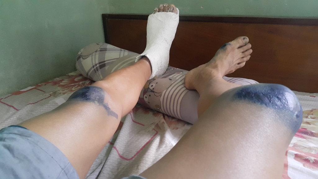 vi sao nguoi dan nhot trom cho vao long sat