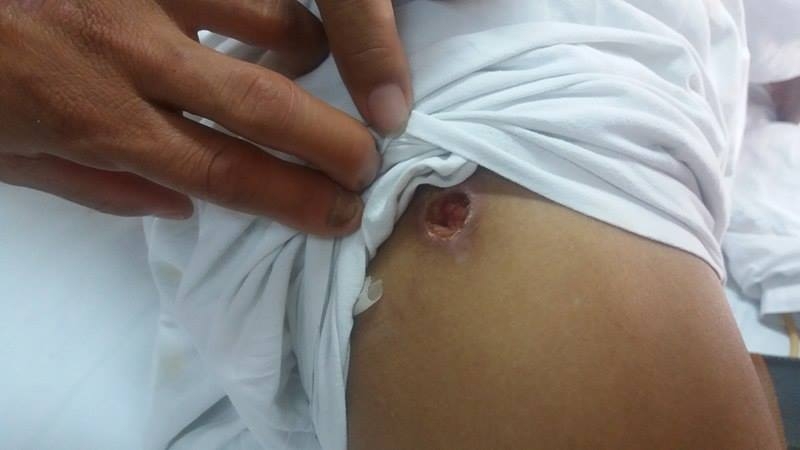 di rung hai mang bi gau tat vao mat khien hong 2 mat