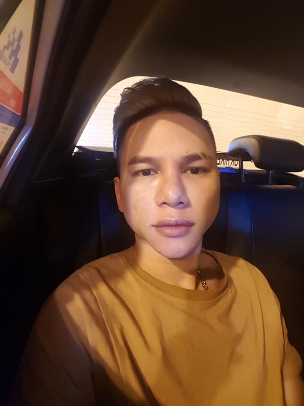 khuon mat bien dang den khong the nhan ra cua sao viet vi pttm