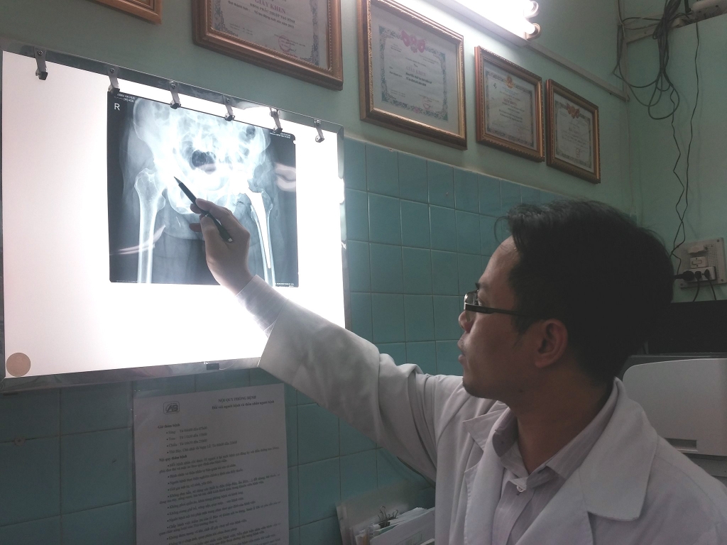 dot bien gien khien nhieu nguoi viet chan ngan lai 7cm