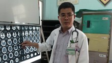 Hé lộ ‘giờ vàng’ để cứu sống bệnh nhân bị đột quỵ