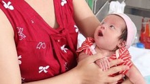 Cứu sống bé sinh non phù toàn thân, không thở, tim rời rạc