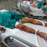 thu mua lon benh om gia re ve giet mo de ban kiem loi