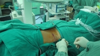 thuc pham nen an va kieng doi voi nguoi mac benh soi tui mat