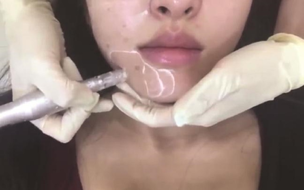 mang hoa lau dai khi thuc hien trao luu cay phan cc cho da