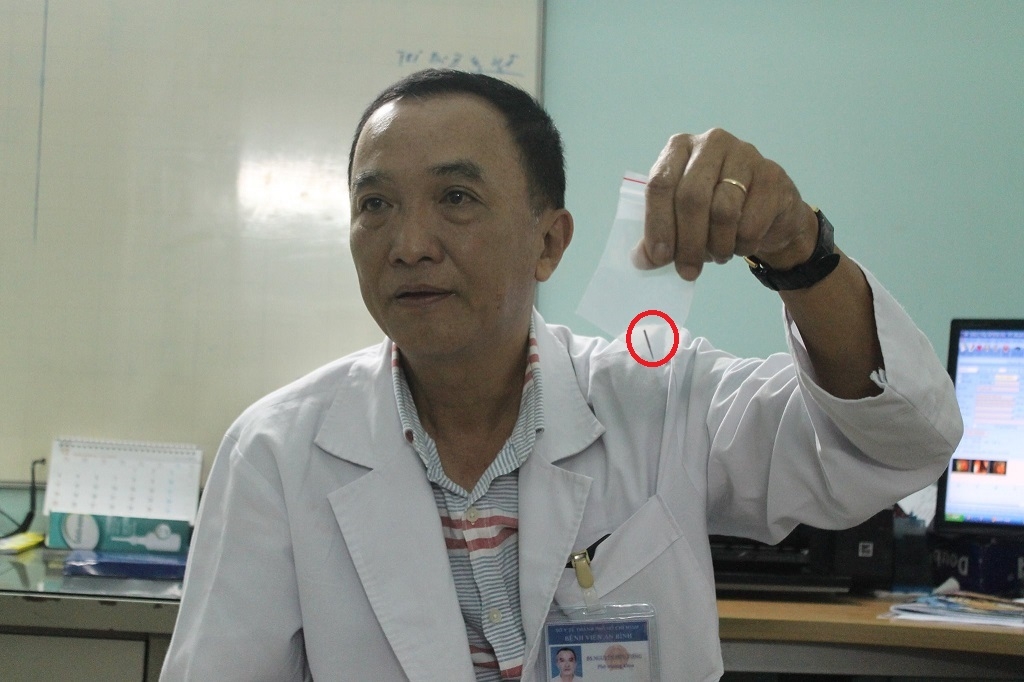 di trong rang mot phu nu nuot phai mui khoan vao bung