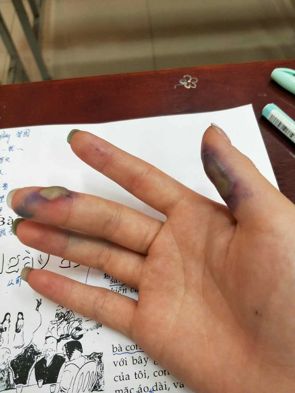nhieu nguoi nhap vien vi bi kien ba khoang tan cong o tp hcm