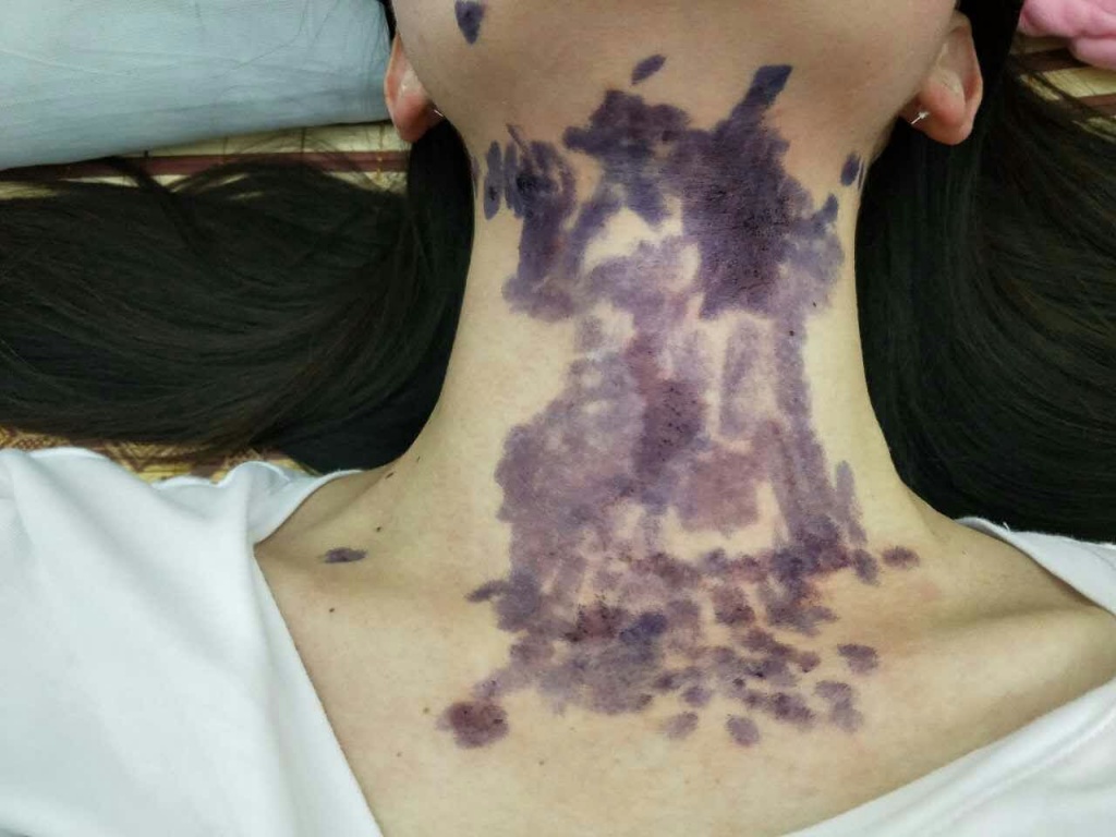 nhieu nguoi nhap vien vi bi kien ba khoang tan cong o tp hcm