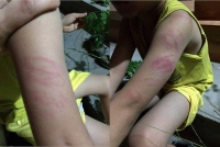 buoc thoi viec doi voi thay giao bi to danh hoc sinh chay mau mui