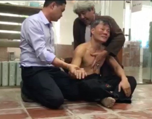 man ti thi cua vo su vinh xuan voi cao thu karate