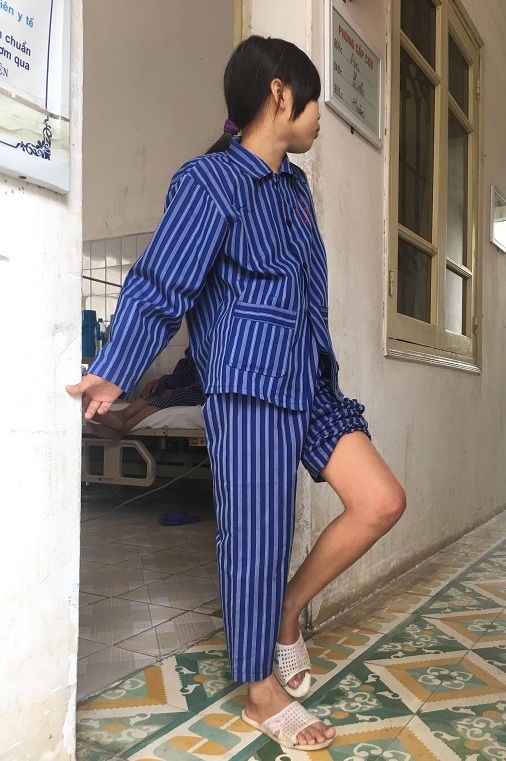 chan be gai khong gap duoi duoc do bo thuoc nam