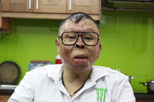 chien si duy nhat song sot vu may bay roi hanh phuc nhan doi tay gia