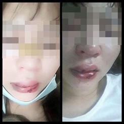 Cô gái giúp đỡ người lạ rồi bị đánh nói gì?