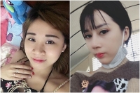 ngo ngang truoc su lot xac nho phau thuat tham my cua me don than tung bi miet thi xau ma che quy hon