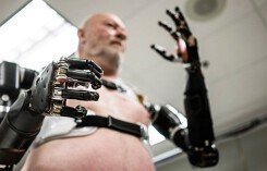 Người đàn ông đầu tiên trên thế giới sống với cánh tay robot điều khiển bằng trí não