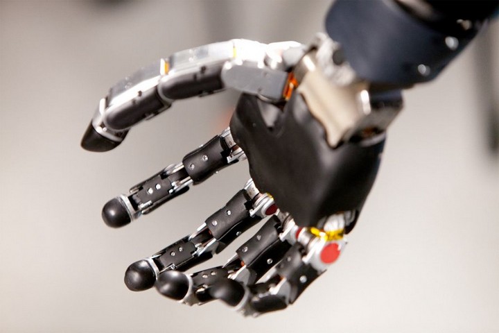 nguoi dan ong dau tien tren the gioi song voi canh tay robot dieu khien bang tri nao