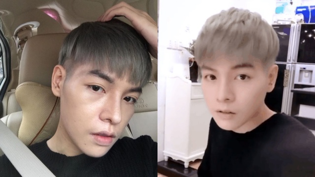 duc phuc chi bao nhieu tien de phau thuat tham my