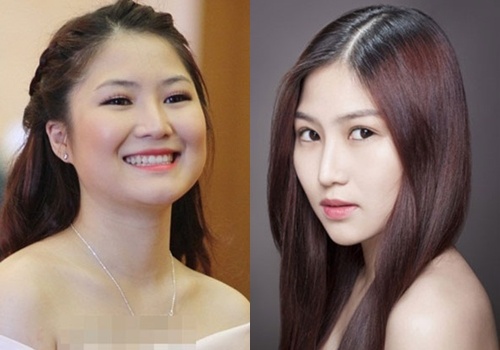duc phuc phau thuat ai cung khen tru huong tram