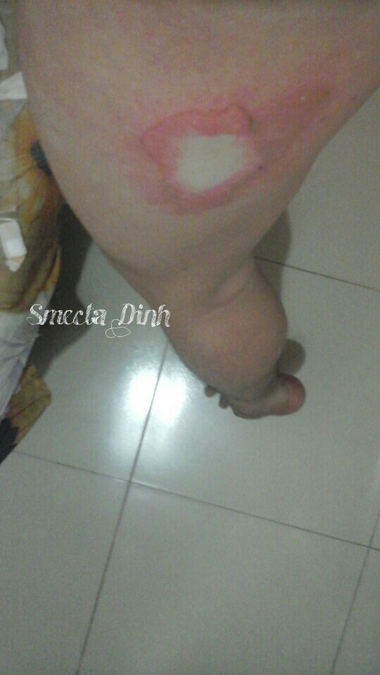 xiaomi mi4 xach tay bat ngo phat no tai viet nam gay bong cho chu nhan