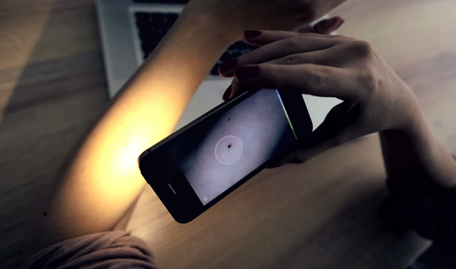 chi can camera smartphone de phat hien va chan doan ung thu da buoc tien cong nghe dot pha cua ibm