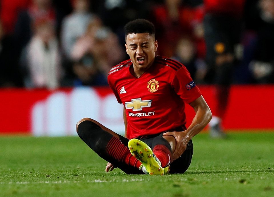 mu ton that nang ne sau that bai truoc psg
