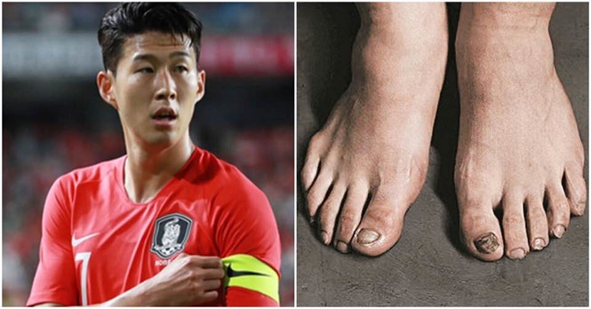 Son Heung-Min và hệ quả cho suất miễn nghĩa vụ quân sự Hàn Quốc son heung min va he qua cho suat mien nghia vu quan su han quoc
