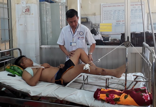 canh sat co dong bi quai xe tong xe chan thuong so nao