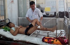 Cảnh sát cơ động bị 'quái xế' tông xe chấn thương sọ não