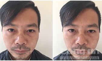 ga dan ong bat nguoi tinh boi thuong tuoi thanh xuan