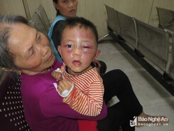 Vụ bé trai 2 tuổi bị bạo hành ở Nghệ An: Triệu tập bố dượng