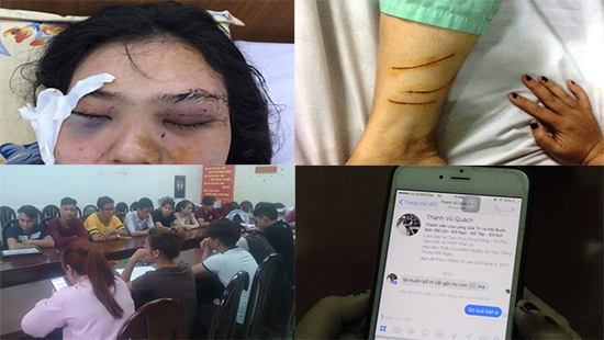 buoc dau lam ro nguyen nhan khien co gai bi cat tai