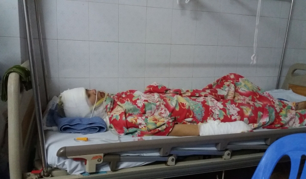 nguoi vo bi chong cu tat axit bong toan than con khong muon anh ay bi di tu