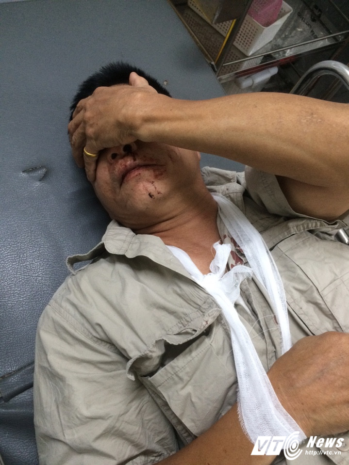 nhom con do truy sat da man nguoi dan ong 61 tuoi o ha noi