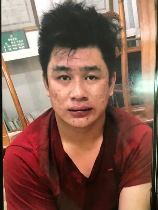dang lam ro 1 so doi tuong khac trong vu hiep si bi giet