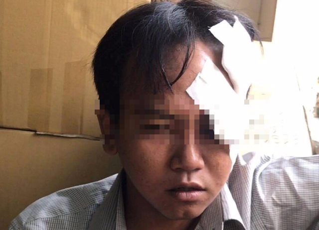 dinh chi dieu tra vu bao ve dan pho sat hai be trai 6 tuoi