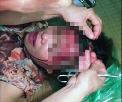 Hải Phòng: Đến nhà 'bồ nhí' gọi chồng lại bị đánh vỡ đầu